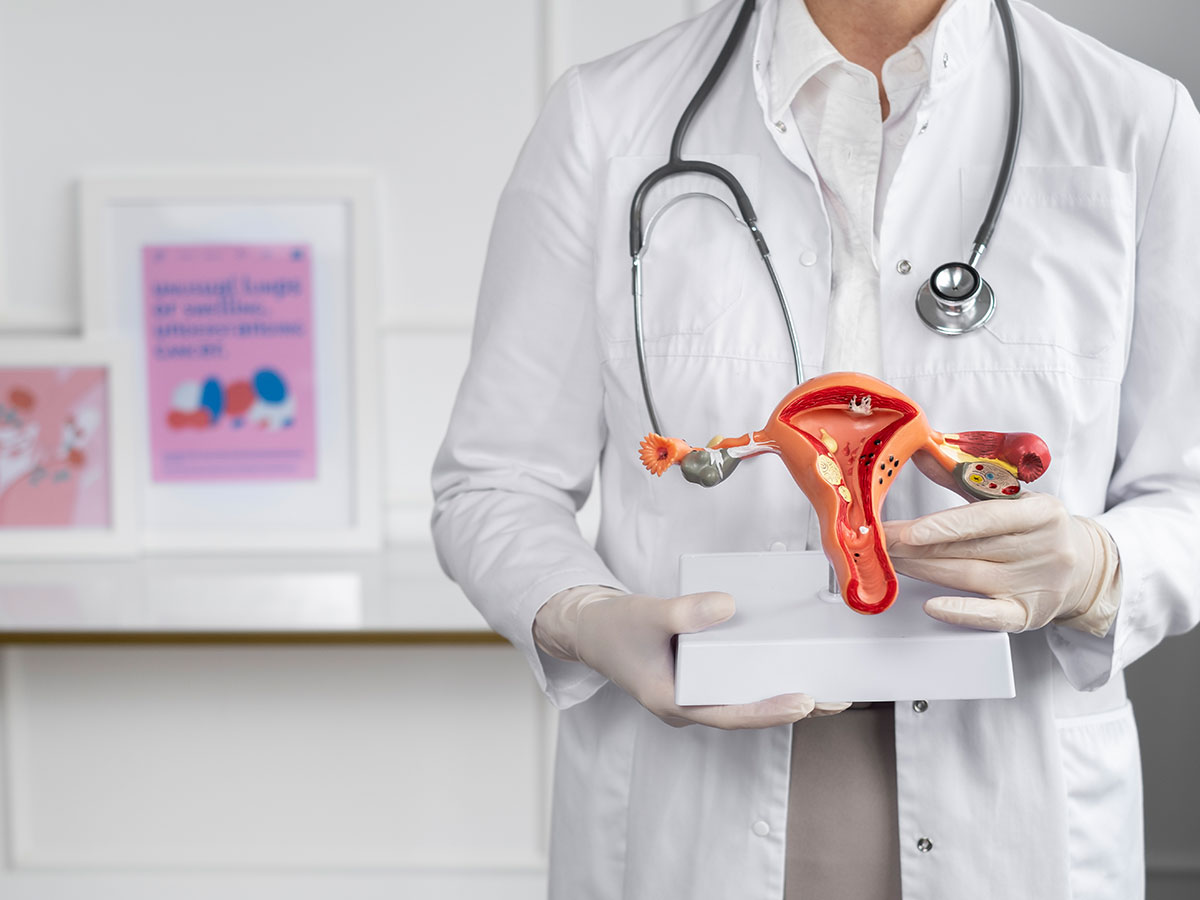 Managing PCOS: Diet, Exercise, and Treatment